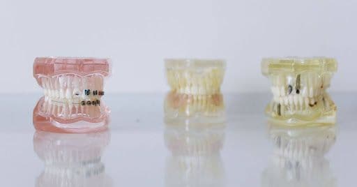Präzision, Handwerk und Teamgeist: Die berufliche Welt der Kieferorthopädie